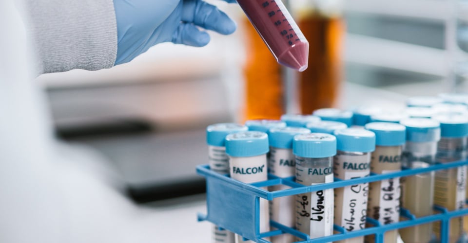 Types of control charts image